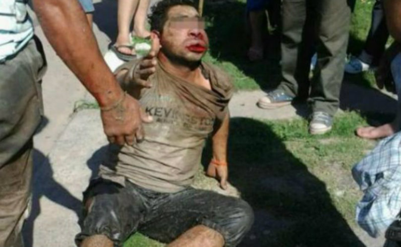 Terminó hospitalizado