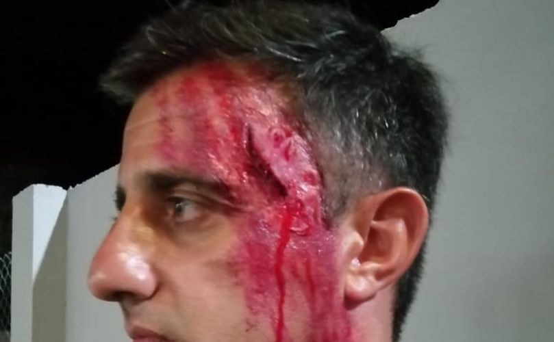 Uno de los actores del simulacro